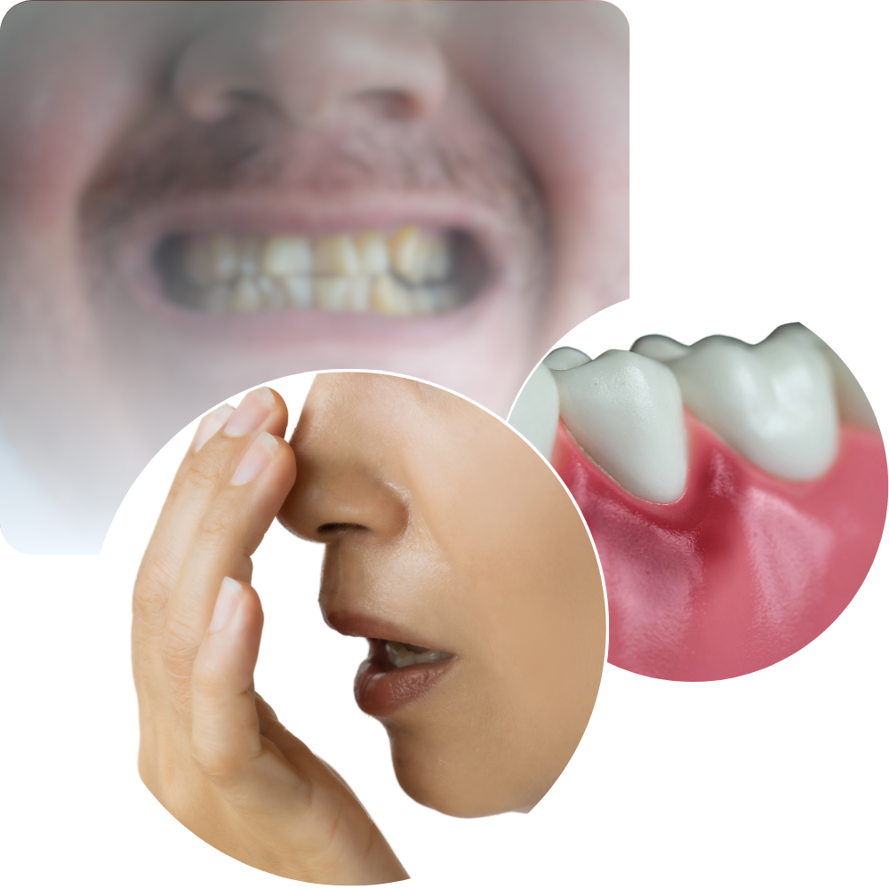 Hampaan juurihoito